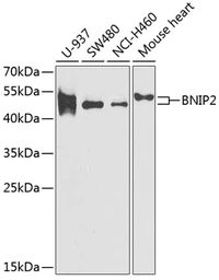 Anti-BNIP2 antibody used in Western Blot (WB). GTX30091