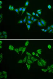 Anti-BNIP2 antibody used in Immunocytochemistry/ Immunofluorescence (ICC/IF). GTX30091