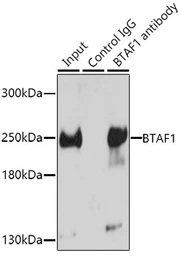 Anti-TAF172 antibody used in Immunoprecipitation (IP). GTX30095