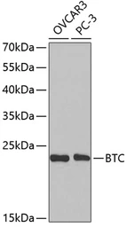 Anti-Betacellulin antibody used in Western Blot (WB). GTX30096