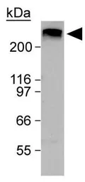 Anti-ATM antibody used in Western Blot (WB). GTX30104