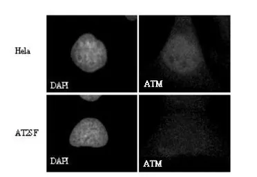 Anti-ATM antibody used in Immunocytochemistry/ Immunofluorescence (ICC/IF). GTX30104