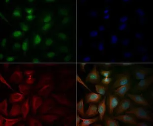 Anti-ATM antibody used in Immunocytochemistry/ Immunofluorescence (ICC/IF). GTX30104