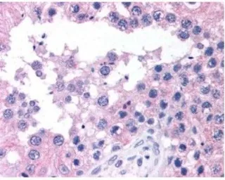 Anti-ATM antibody used in IHC (Paraffin sections) (IHC-P). GTX30104