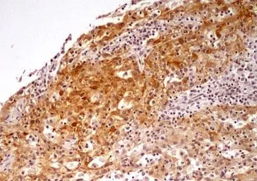 Anti-NTH1 antibody used in IHC (Paraffin sections) (IHC-P). GTX30107