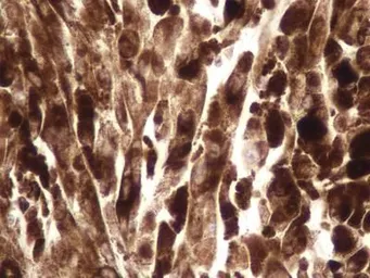 Anti-NTH1 antibody used in IHC (Paraffin sections) (IHC-P). GTX30107