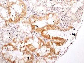 Anti-NTH1 antibody used in IHC (Paraffin sections) (IHC-P). GTX30107