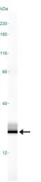 Anti-MTH1 antibody used in Western Blot (WB). GTX30108