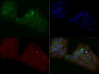 Anti-MTH1 antibody used in Immunocytochemistry/ Immunofluorescence (ICC/IF). GTX30108