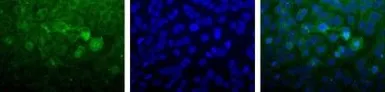 Anti-MTH1 antibody used in Immunocytochemistry/ Immunofluorescence (ICC/IF). GTX30108