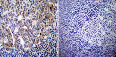 Anti-Progesterone Receptor (phospho Ser190) antibody [1154] used in IHC (Paraffin sections) (IHC-P). GTX30164