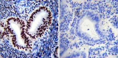Anti-Progesterone Receptor (phospho Ser190) antibody [1154] used in IHC (Paraffin sections) (IHC-P). GTX30164