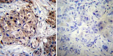 Anti-Progesterone Receptor (phospho Ser190) antibody [1154] used in IHC (Paraffin sections) (IHC-P). GTX30164