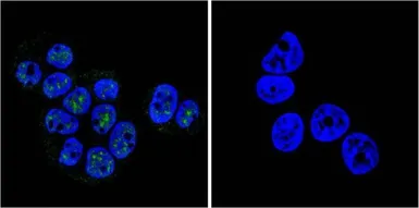 Anti-Progesterone Receptor (phospho Ser190) antibody [1154] used in Immunocytochemistry/ Immunofluorescence (ICC/IF). GTX30164