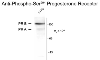 Anti-Progesterone Receptor (phospho Ser294) antibody [608] used in Western Blot (WB). GTX30165