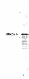 Anti-NF-L antibody used in Western Blot (WB). GTX30190