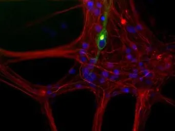 Anti-NF-L antibody used in Immunocytochemistry/ Immunofluorescence (ICC/IF). GTX30190
