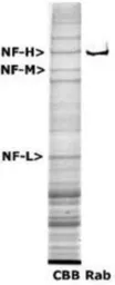 Anti-NF-H antibody used in Western Blot (WB). GTX30192