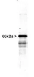 Anti-alpha Internexin antibody used in Western Blot (WB). GTX30195