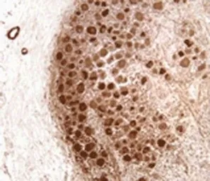 Anti-Neurofibromin antibody [McNFn27b] used in IHC (Paraffin sections) (IHC-P). GTX30209