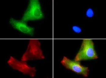 Anti-PLTP antibody used in Immunocytochemistry/ Immunofluorescence (ICC/IF). GTX30230