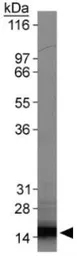 Anti-Survivin antibody [60.11] used in Western Blot (WB). GTX30241