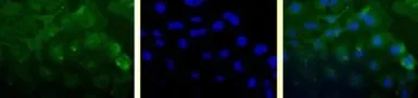 Anti-Survivin antibody [60.11] used in Immunocytochemistry/ Immunofluorescence (ICC/IF). GTX30241