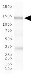 Anti-CHAF1A antibody [SS 1 1-13] used in Western Blot (WB). GTX30243