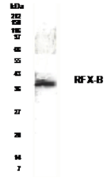 Anti-RFXANK antibody used in Western Blot (WB). GTX30257