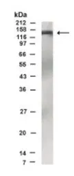 Anti-IKAP antibody used in Western Blot (WB). GTX30260