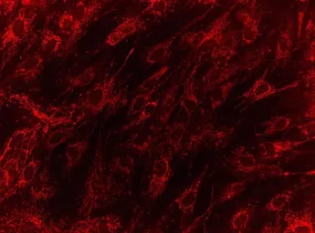 Anti-HMGCL antibody [9F5AB9] used in Immunocytochemistry/ Immunofluorescence (ICC/IF). GTX30324