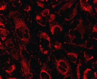 Anti-HSDL2 antibody [2A11BG6AH6] used in Immunocytochemistry/ Immunofluorescence (ICC/IF). GTX30325
