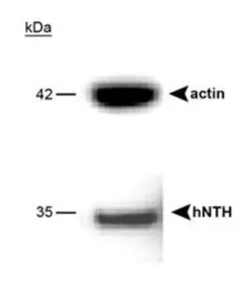 Anti-NTH1 antibody used in Western Blot (WB). GTX30397