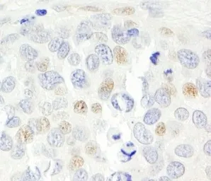 Anti-CDKN2A / p14ARF antibody used in IHC (Paraffin sections) (IHC-P). GTX30433