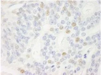 Anti-CDKN2A / p14ARF antibody used in IHC (Paraffin sections) (IHC-P). GTX30434