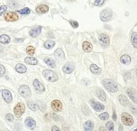 Anti-CDKN2A / p14ARF antibody used in IHC (Paraffin sections) (IHC-P). GTX30434
