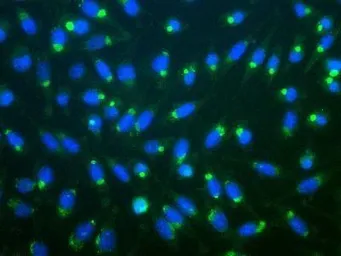 Anti-Ubiquitin antibody used in Immunocytochemistry/ Immunofluorescence (ICC/IF). GTX30439