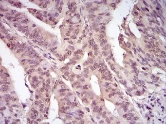 Anti-Ubiquitin antibody used in IHC (Paraffin sections) (IHC-P). GTX30439