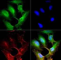 Anti-SR-BI antibody used in Immunocytochemistry/ Immunofluorescence (ICC/IF). GTX30467