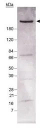 Anti-Fatty Acid Synthase antibody used in Western Blot (WB). GTX30468