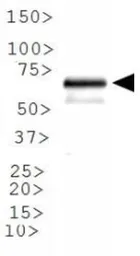 Anti-ABCE1 antibody used in Western Blot (WB). GTX30470