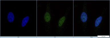 Anti-EP300 antibody [RW128] used in Immunocytochemistry/ Immunofluorescence (ICC/IF). GTX30614