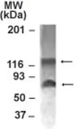 Anti-NABC1 antibody used in Western Blot (WB). GTX30622