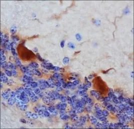 Anti-Thimet Oligopeptidase antibody [4D6] used in IHC (Paraffin sections) (IHC-P). GTX30631