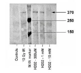 Anti-ATM (phospho Ser1981) antibody [10H11.E12] used in Western Blot (WB). GTX30636