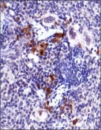 Anti-ATM (phospho Ser1981) antibody [10H11.E12] used in IHC (Paraffin sections) (IHC-P). GTX30636