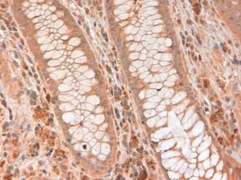 Anti-RNase L antibody [2E9] used in IHC (Paraffin sections) (IHC-P). GTX30638