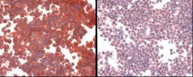 Anti-SLC31A1 / CTR1 antibody used in Immunocytochemistry/ Immunofluorescence (ICC/IF). GTX30642