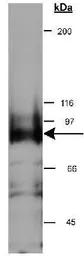 Anti-NSP-5a3a antibody used in Western Blot (WB). GTX30651