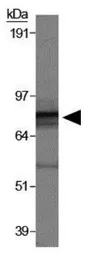Anti-NSP-5a3a antibody used in Western Blot (WB). GTX30652